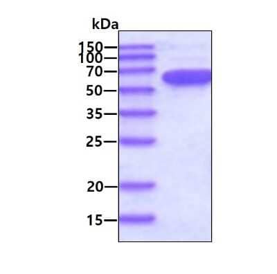 SDS-Page: Recombinant Human PKM2 His Protein [NBP1-30292] - 3ug by SDS-PAGE under reducing condition and visualized by coomassie blue stain.